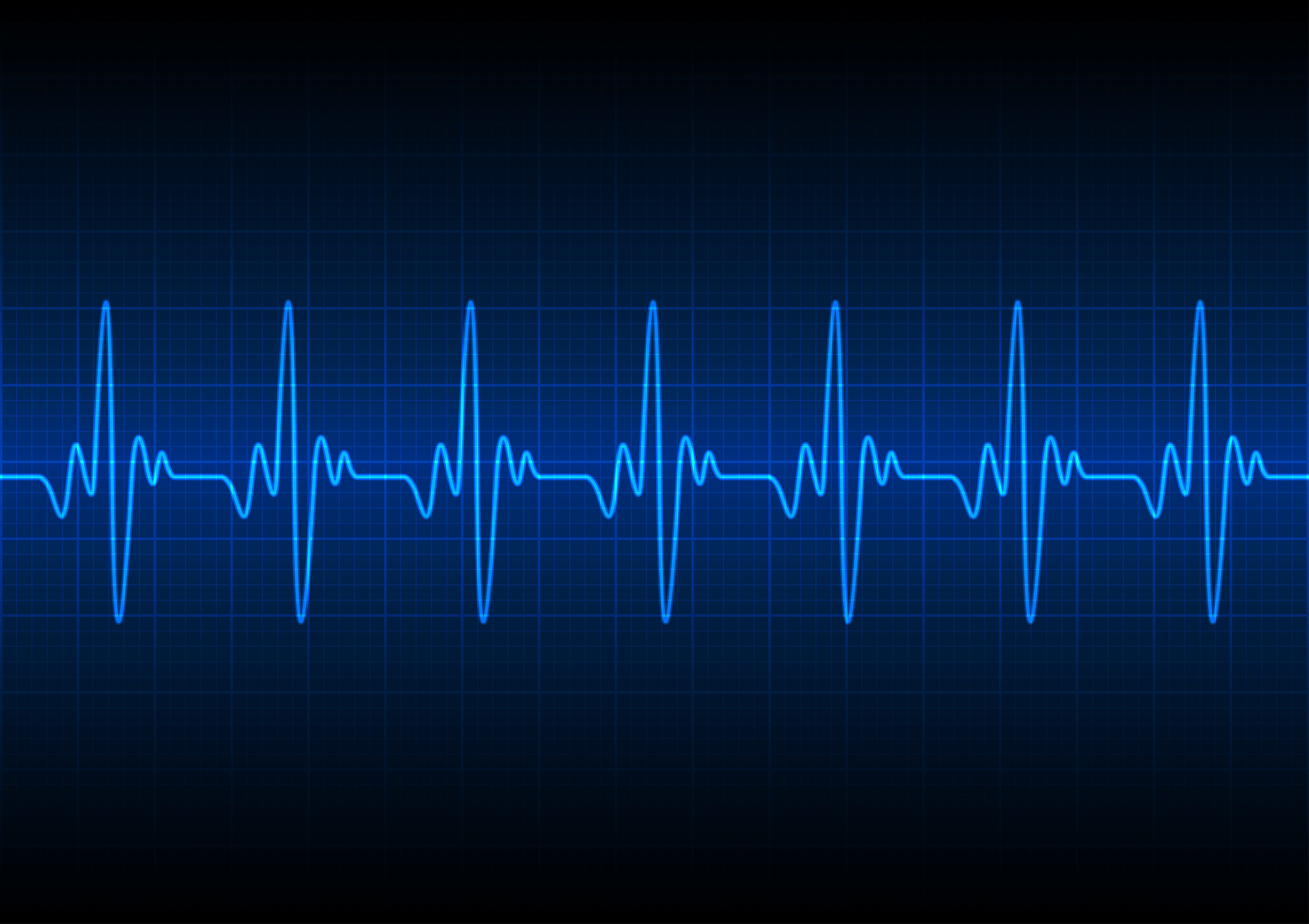 When Authentication Is Just A Heartbeat Away