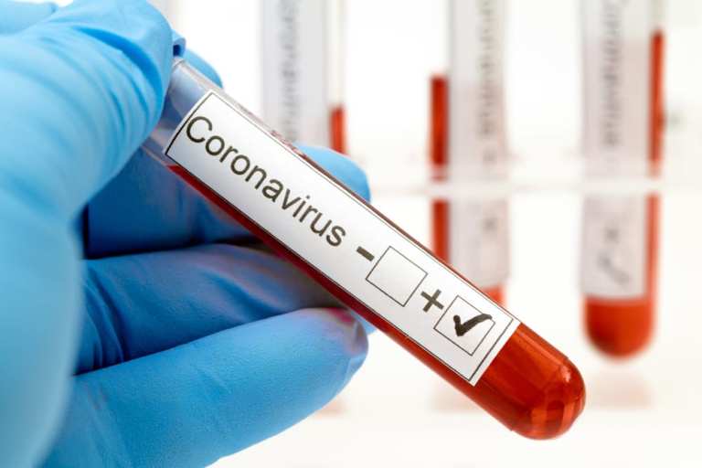 Can A Startup Fill The Coronavirus Testing Gap?