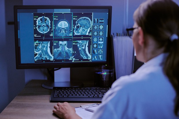 Voio Raises $8.6 Million to Bring AI to Radiology